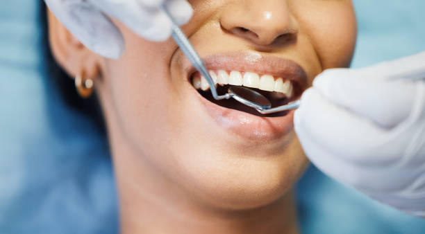 Best Emergency Dentist No Insurance  in De Graff, OH