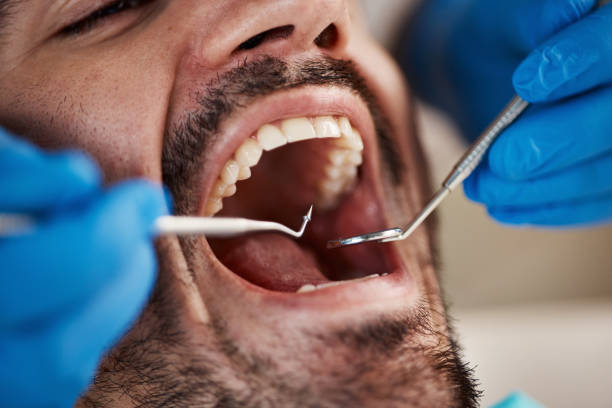 Best Affordable Emergency Dental Care  in De Graff, OH