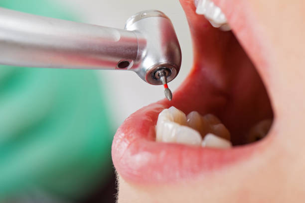 Best Cracked Tooth Emergency Dentist  in De Graff, OH